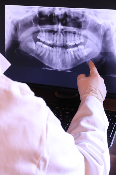 Best Emergency Root Canal Treatment in Clarkston, GA