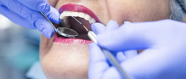 Best Emergency Tooth Extraction in Clarkston, GA